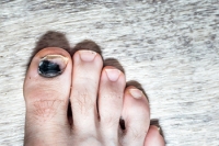 Common Causes of Toe Pain