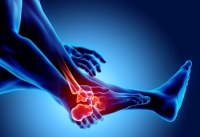 The Pain in Your Feet May Indicate Rheumatoid Arthritis