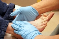 How Diabetic Patients Should Care for Their Feet