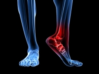 What Causes Heel Pain?